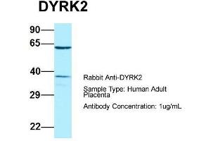 Host: Rabbit  Target Name: DYRK2  Sample Tissue: Human Adult Placenta  Antibody Dilution: 1. (DYRK2 antibody  (C-Term))