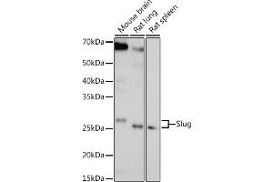 Western blot analysis of extracts of various cell lines, using Slug antibody (ABIN6127298, ABIN6148181, ABIN6148183 and ABIN6217314) at 1:1000 dilution. (SLUG antibody  (AA 126-268))