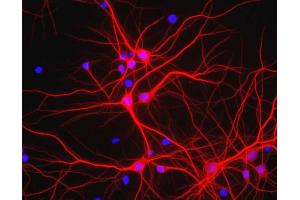 View of mixed neuron/glial cultures stained with MAP2 / MAP-2 antibody (red). (MAP2 antibody)