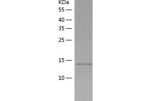 Western Blotting (WB) image for Small Nuclear Ribonucleoprotein 25kDa (U11/U12) (SNRNP25) (AA 1-132) protein (His tag) (ABIN7288624) (SNRNP25 Protein (AA 1-132) (His tag))
