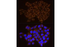 Immunofluorescence analysis of HeLa cells using CECR5 Rabbit mAb (ABIN7266128) at dilution of 1:100 (40x lens). (CECR5 antibody)