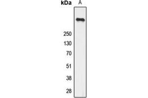 Western blot analysis of Ryanodine Receptor 2 (pS2808) expression in U251 (A) whole cell lysates. (RYR2 antibody  (pSer2808))