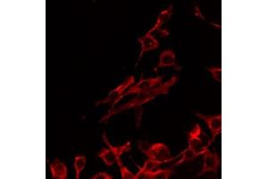 ABIN6268760 staining Hela by IF/ICC. (PRLHR antibody  (Internal Region))