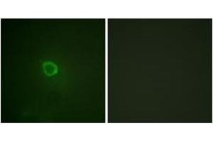 Immunofluorescence analysis of HepG2 cells, using IL-13R alpha1 (Phospho-Tyr405) Antibody.