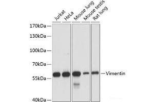 Western blot analysis of extracts of various cell lines using Vimentin Polyclonal Antibody at dilution of 1:1000. (Vimentin antibody)