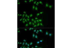 Immunofluorescence analysis of MCF7 cells using HPS1 Polyclonal Antibody (HPS1 antibody)