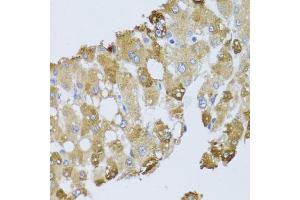 Immunohistochemistry of paraffin-embedded human liver injury using BNIP3 antibody. (BNIP3 antibody)