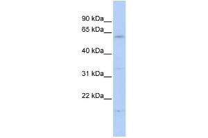 WB Suggested Anti-FBXW11 Antibody Titration:  0.