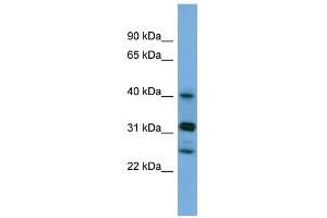 WB Suggested Anti-PPHLN1 Antibody Titration: 0.