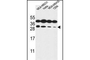 STX10 Antibody (N-term) (ABIN653883 and ABIN2843130) western blot analysis in MDA-M,Hela,MDA-M,CEM cell line lysates (35 μg/lane).