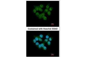 ICC/IF Image Immunofluorescence analysis of paraformaldehyde-fixed A431, using SEPHS2, antibody at 1:500 dilution. (SEPHS2 antibody)