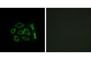 Peptide - +Western blot analysis of extracts from HUVEC cells and COLO cells, using ERD22 antibody. (KDELR2 antibody  (Internal Region))