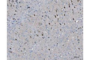 IHC analysis of ARFGAP1 using anti-ARFGAP1 antibody (ABIN4886474). (ARFGAP1 antibody  (AA 1-183))