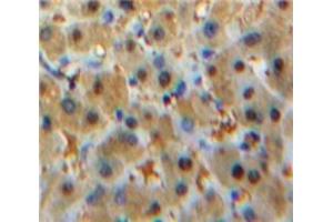 Immunohistochemistry (IHC) image for anti-Signal Transducer and Activator of Transcription 2, 113kDa (STAT2) (AA 658-912) antibody (ABIN1860647)