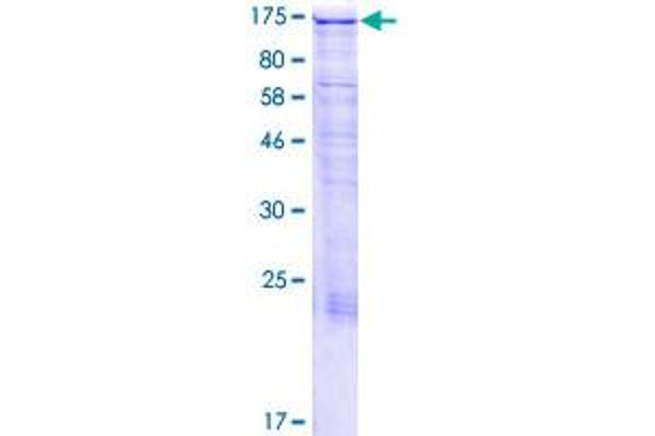 MAP1S Protein (AA 1-1059) (GST tag)