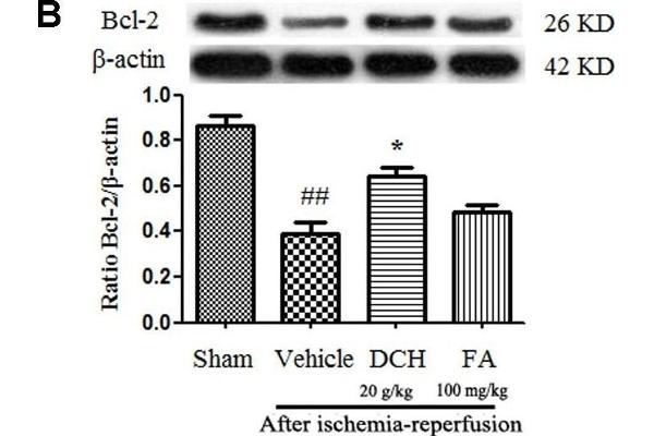 Bcl-2 antibody  (AA 101-160)
