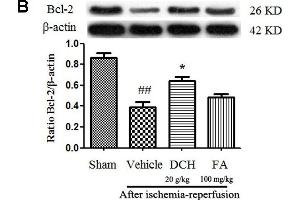 Danshen-Chuanxiong-Honghua extract alleviated apoptosis and inhibited pro-inflammatory cytokine production in the injured hippocampus 24 h after cerebral ischemia and reperfusion. (Bcl-2 antibody  (AA 101-160))