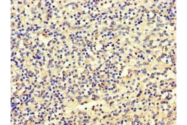 SET Binding Factor 2 antibody  (AA 1585-1813)