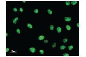 Immunostaining analysis in HeLa cells. (E2F6 antibody)