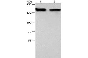 Western Blot analysis of 293T and hela cell using NCAPD2 Polyclonal Antibody at dilution of 1:425 (NCAPD2 antibody)