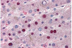 Human Liver (formalin-fixed, paraffin-embedded) stained with NACA antibody ABIN337196 at 5 ug/ml followed by biotinylated goat anti-rabbit IgG secondary antibody ABIN481713, alkaline phosphatase-streptavidin and chromogen. (NACA antibody  (C-Term))