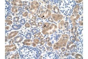SLC38A1 antibody was used for immunohistochemistry at a concentration of 4-8 ug/ml to stain Epithelial cells of renal tubule (arrows) in Human Kidney. (SLC38A1 antibody  (Middle Region))