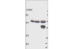 Western blot using  Affinity Purified anti-p44 MAP Kinase (ERK1) antibody shows detection of ERK1 in whole cell lysates prepared from mouse brain (left), mouse kidney (center) and mouse intestine (right). (ERK1 antibody  (C-Term))