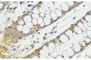Immunohistochemistry (Paraffin-embedded Sections) (IHC (p)) image for anti-HECT Domain and Ankyrin Repeat Containing, E3 Ubiquitin Protein Ligase 1 (HACE1) antibody (ABIN7264832)