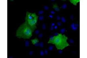 Anti-RIC8A mouse monoclonal antibody (ABIN2453596) immunofluorescent staining of COS7 cells transiently transfected by pCMV6-ENTRY RIC8A (RC211359). (RIC8A antibody)