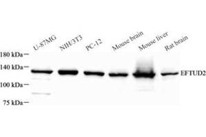 Western blot analysis of EFTUD2 (ABIN7073810) at dilution of 1: 500