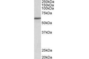 Western Blotting (WB) image for anti-Zinc Finger Protein 703 (ZNF703) (Internal Region) antibody (ABIN2466469) (ZNF703 antibody  (Internal Region))