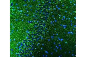 IF analysis of EAAT1/SLC1A3 using anti-EAAT1/SLC1A3 antibody (ABIN7602879).