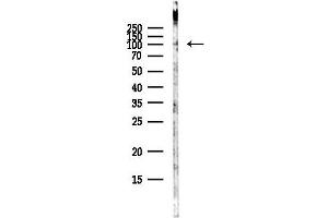 anti-Rap Guanine Nucleotide Exchange Factor (GEF) 3 (RAPGEF3) (C-Term) antibody