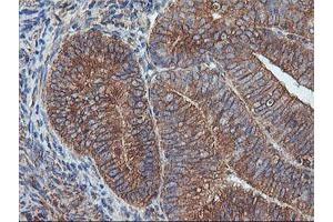 Image no. 7 for anti-IlvB (Bacterial Acetolactate Synthase)-Like (ILVBL) antibody (ABIN1498878)