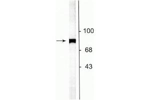 Western blot of rat striatal lysate showing specific labeling of the ~75 kDa NSF protein. (NSF antibody  (C-Term))
