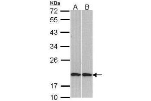 WB Image Sample (30 ug of whole cell lysate) A: H1299 B: Molt-4 , 12% SDS PAGE antibody diluted at 1:1000 (Cofilin 2 antibody)
