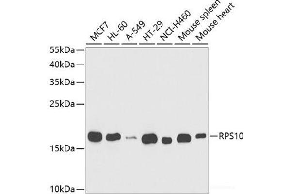 RPS10 antibody