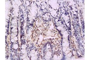 Formalin-fixed and paraffin embedded rat colon tissue labeled with Anti-P-selectin Polyclonal Antibody (ABIN670131), Unconjugated at 1:200, followed by conjugation to the secondary antibody and DAB staining (P-Selectin antibody  (AA 701-768))