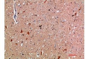 Immunohistochemical analysis of paraffin-embedded human-brain, antibody was diluted at 1:200 (CD3 epsilon antibody  (AA 31-80))