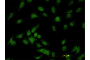 Immunofluorescence of monoclonal antibody to IRAK1 on HeLa cell. (IRAK1 antibody  (AA 530-693))