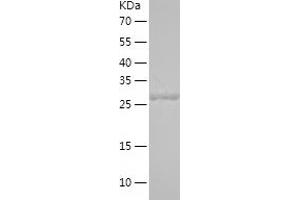 Western Blotting (WB) image for Sulfotransferase Family, Cytosolic, 1A, Phenol-Preferring, Member 1 (SULT1A1) (AA 1-291) protein (His tag) (ABIN7286441) (SULT1A1 Protein (AA 1-291) (His tag))