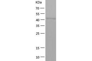 Western Blotting (WB) image for Acetyl-CoA Acetyltransferase 1 (ACAT1) (AA 34-427) protein (His tag) (ABIN7285735) (ACAT1 Protein (AA 34-427) (His tag))