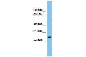 AK2 antibody used at 1 ug/ml to detect target protein. (Adenylate Kinase 2 antibody  (Middle Region))