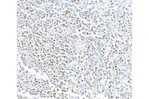 Immunohistochemistry (IHC) image for anti-Transcription Factor 7 (T-Cell Specific, HMG-Box) (TCF7) (AA 200-250) antibody (ABIN7449420) (Recombinant TCF7 antibody  (AA 200-250))