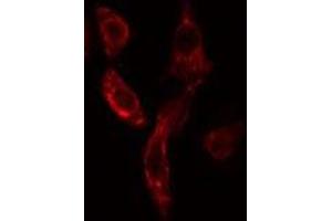 ABIN6275886 staining COLO205 cells by IF/ICC. (VASH1 antibody  (Internal Region))