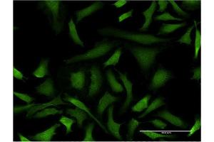 Immunofluorescence of monoclonal antibody to GAS2L3 on HeLa cell. (GAS2L3 antibody  (AA 595-694))