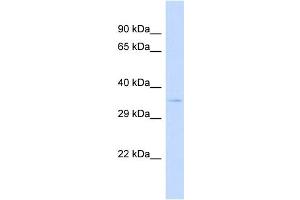 Host:  Rabbit  Target Name:  SPPL2B  Sample Type:  293T Whole cell lysates  Antibody Dilution:  1. (SPPL2B antibody  (N-Term))