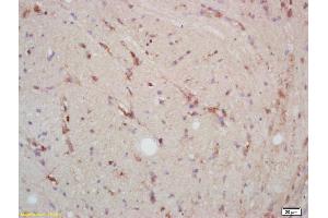 Formalin-fixed and paraffin embedded rat brain labeled with Rabbit Anti p38MAPK/MAPK14/p38Alpha Polyclonal Antibody, Unconjugated (ABIN671241) at 1:200 followed by conjugation to the secondary antibody and DAB staining