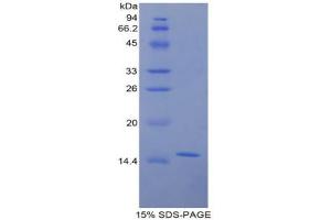 SDS-PAGE analysis of Rat Galactosylceramidase Protein. (GALC Protein)