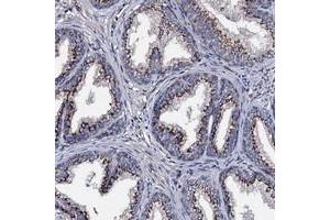 Immunohistochemical staining of human prostate with C11orf34 polyclonal antibody  shows strong cytoplasmic positivity in glandular cells at 1:10-1:20 dilution. (Plet1 antibody)